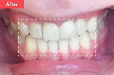 Case 02 After