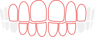 Lite 歯並びイラスト